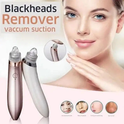 5-in-1 Electric Blackhead Remover | Facial Pore Cleanser | 5-Speed Acne Pore Cleaner - THELOOTSALE